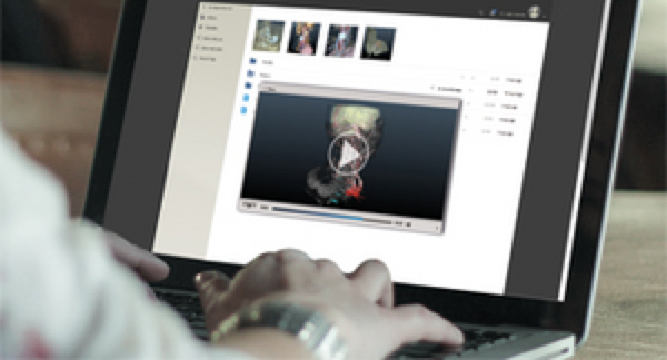 WebSeg – Webbasierte Segmentierungsplattform für patientenindividuelle 3D-Modelle